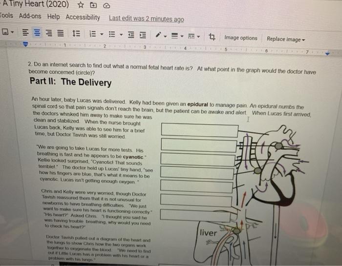 Crimes of the heart a case study on cardiac anatomy