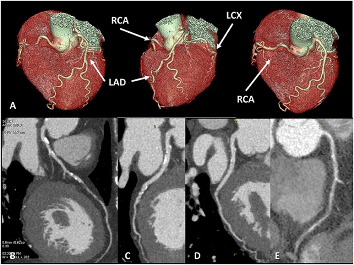 Crimes of the heart a case study on cardiac anatomy